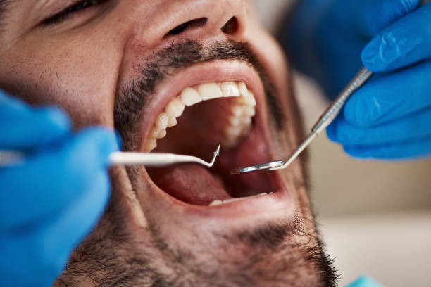 Best Emergency TMJ Treatment in Laurel, MS